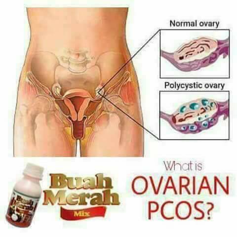 Buah Merah Mix and PCOS?